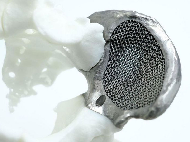 Implante de pelvis. Material: titanio. Impresora: FS271M.